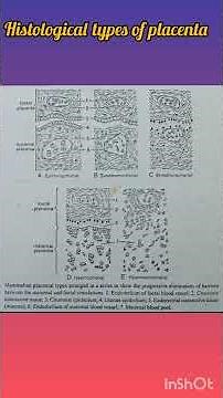 Histological types of placenta #thecrunchbiochem