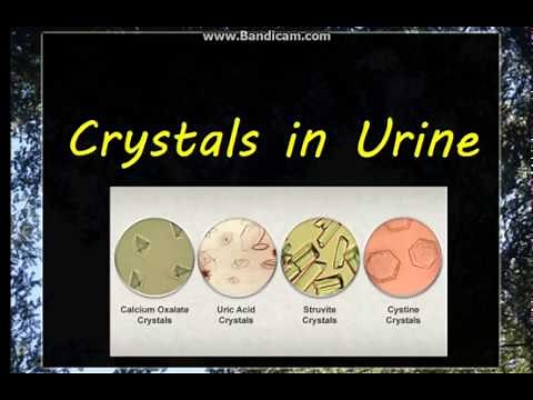 Urine Examination(3)-- Crystals