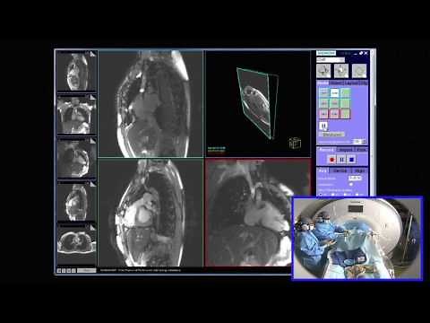 Right Heart Catheterization Live Stream