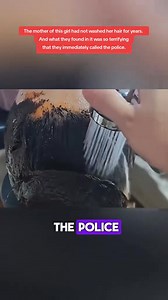 226K views · 641 reactions | The mother of this girl had not washed her hair for years. And what they found in it was so terrifying that they immediately called the police. Part 2 #story #shockingstory #truestory #lifestory #realstory #storytime #storytelling #storyteller | True Stories | Facebook