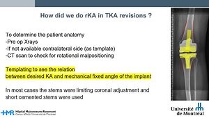 Revision Total Knee Arthroplasty With Restricted Kinematic Alignment