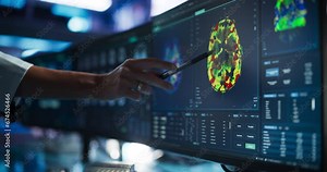 Modern Medical Research Center: Anonymous Doctor Pointing At Desktop Computer Monitor With Software Visualizing Human Brain Based On MRI Scan. Neurologist Looking For Impacted Areas By Brain Damage.