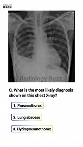 733 reactions · 85 shares | 嗢 Radiology Quiz: Can You Identify the...