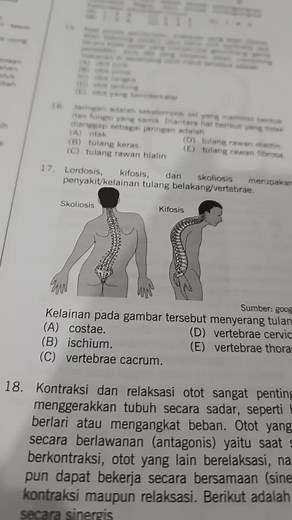 Contoh 3D untuk Memahami Biologi Kelas 12