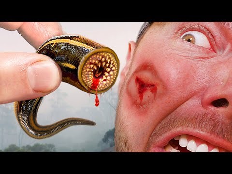 BITTEN by Parasitic Worms and other Bizarre Creatures!