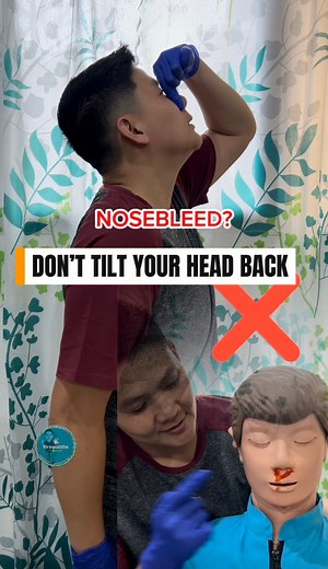 86K views · 1.5K reactions | Got a nosebleed? Don’t tilt your head back—lean forward, pinch your nose, and breathe through your mouth. Stay calm and let the bleeding stop safely. 喝✅ #firstaid #nosebleeds #NosebleedFirstAid #firstaidtraining #firefighter #firefightertraining #firefighternurse #firenuzzle | firenuzzle | Facebook