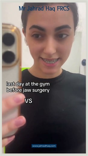 Amber Before & After Surgery