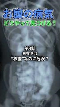 お腹の病気、どうやって見つける？ ④「ERCPは“検査”なのに危険？」 #消化器内科 #ERCP #MRCP #胆石 #胆管結石 #膵炎 #膵臓 #胆管 #内視鏡検査 #医療解説 #Shorts