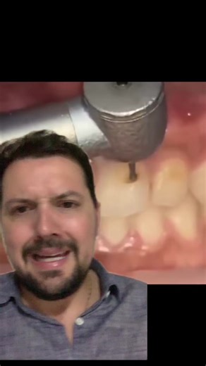 Cárie no Dente da Frente! Descubra Como Prevenir