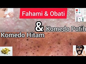 Mengatasi Komedo Hitam (Terbuka) & Putih (Terutup) | Penyebab Blackheads & Whiteheads |AHA, BHA, PHA