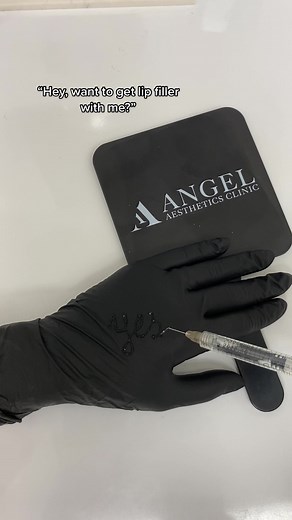 Lip Filler Procedure at Angel Aesthetics Clinic