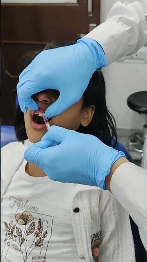 milk Tooth extraction