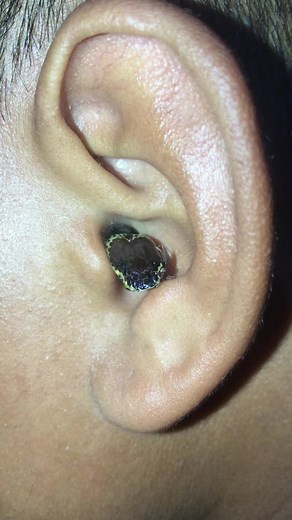 ticksbrazil on TikTok