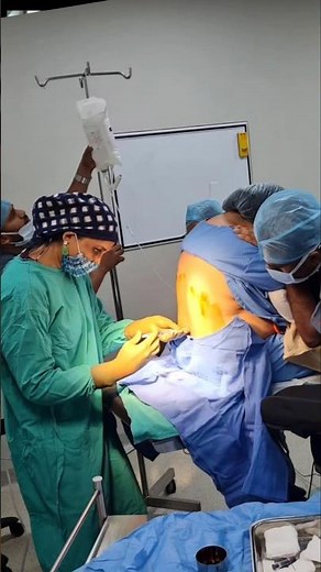 cesarean anesthesia #epiduralinjection #cesareanbirth #labourpain