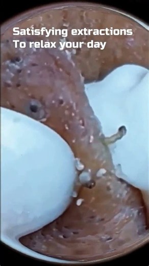 Satisfying extractions to relax your day