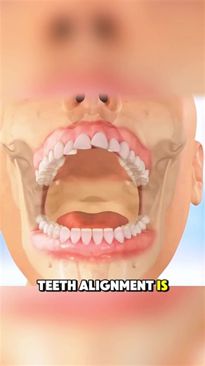 Orthodontic Teeth Alignment Treatment Explained in 3D