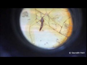 Larva of Anopheles mosquito under dissecting microscope