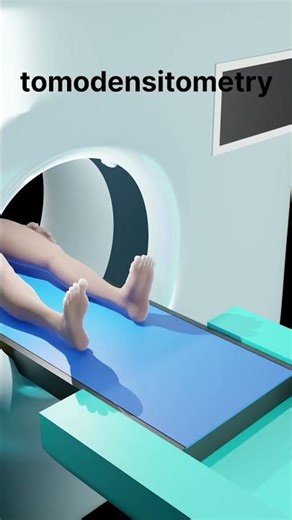 tomodensitomerty (TDM) scanner#scanner #medical #doctor #hospital #medicalstudent