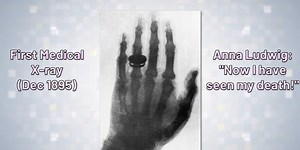 Moment of Science: X-Rays