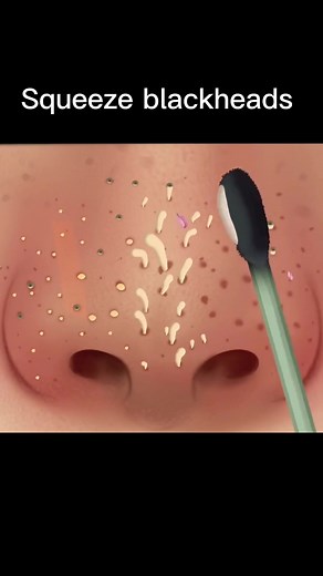 The nose should also be cleaned #fyp #stopmotionanimation #tiktok #foryou #clean #cartoon #asmr #nose #animation