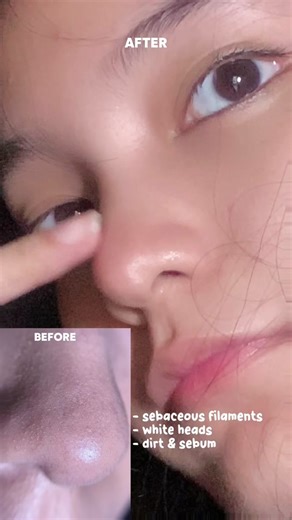 This pore power: cleansing oil & mask duo from @coxir is for my oily and combo skin girlies (out of all cleansing oils this is the only one that didn’t broke me out) #coxir #coxirporepower #kbeauty 🛒Available on Amazon & YesStyle App!! use my code “DIANNE03” on YesStyle for a discount $$