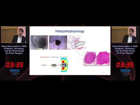 Renal Denervation in 2026: Evidence, Technique & The Road Ahead | TRICO 2026