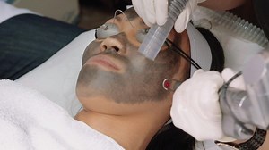 Hollywood Laser Peel: Procedure and Explanation