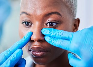 Nose Job Gone Wrong: The Most Common Issues Doctors See—and How They Fix Them