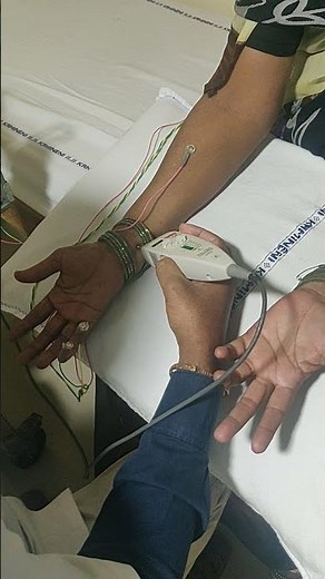 Nerve conduction study