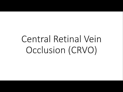 Central Retinal Vein Occlusion (CRVO) - Ophthalmology