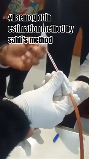 "Haemoglobin estimation by sahli's (acid hematin) method in clinical laboratory 🥰"#bams #mbbs #short
