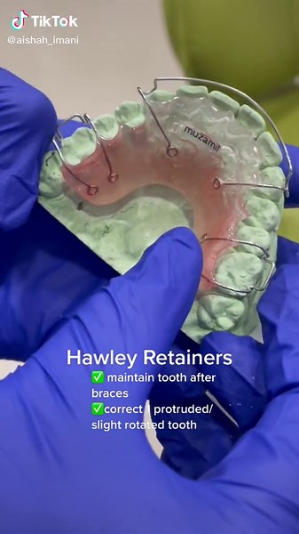 Understanding Hawley Retainers in Dental Procedures