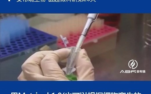 【生物医学实验室日常】Transwell检测细胞侵袭实验技巧1