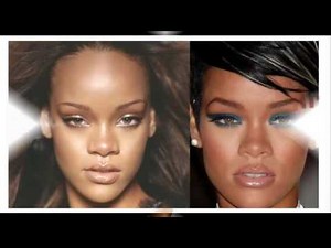 Chirurgie plastique de stars et célébrités🎼