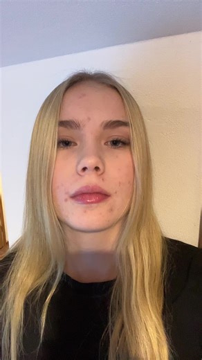 Paha Akne ja Sen Vaikutukset