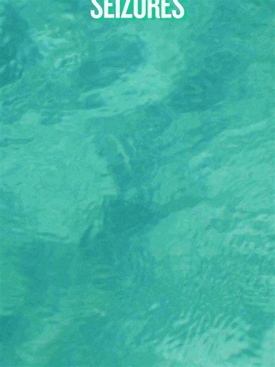 Understanding Seizures: Symptoms, Diagnosis, and Treatment Seizures can be a complex and alarming symptom, often requiring a thorough understanding for effective management. Below, we delve into the symptoms, diagnostic processes, and treatment options available for seizures, particularly when associated with conditions like lupus. Symptoms of Seizures Seizures can manifest in various ways, making it crucial to recognize the signs: Sudden Confusion: Individuals may experience a sudden inability 