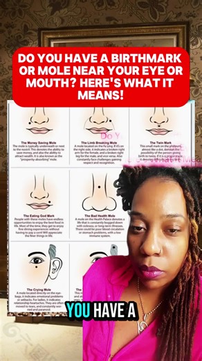 Your birthmark or mole near your eye or mouth isn’t random—it’s a spiritual gift! Are you a seer, a master manifestor, or BOTH?#SpiritualGifts #ManifestationPower #Intuition #SpiritualMeaning #MolesAndBirthmarks