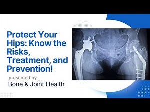 "Understanding Hip Fractures: Causes, Symptoms, and Treatment Options for a Speedy Recovery"