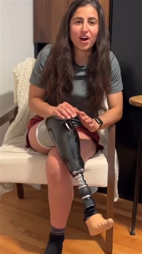 Adaptive Amputees | Prosthetic Life & Adaptive Fitness on Instagram: "My thoughts on osseointegration! #osseointegrationprosthetic #prosthetics #prosthetic #amputeeproblems #amputeelife #amputation #osseointegration #llldam #limbloss #limblossawareness #limblossawarenessmonth"