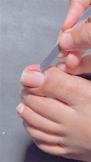 Cuticle Removing #nailart #pedicure #homemade #diy #tutorial #naildesign #footcare