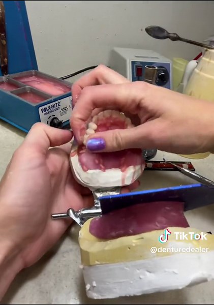 Watch me set the maxillary teeth for a full upper and lower denture set!#dental #dentures #denturegang #satisfying #carving #teeth #lablife #dentallabtech #denturedealer #dentallaboratory #dentalart #toothfairy #dentist #hands #dentureconfidence #art
