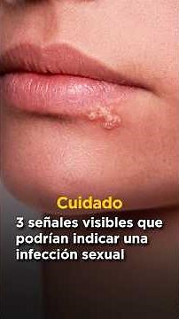 3 visible signs that could indicate a sexually transmitted infection. @laura_primerosauxilios