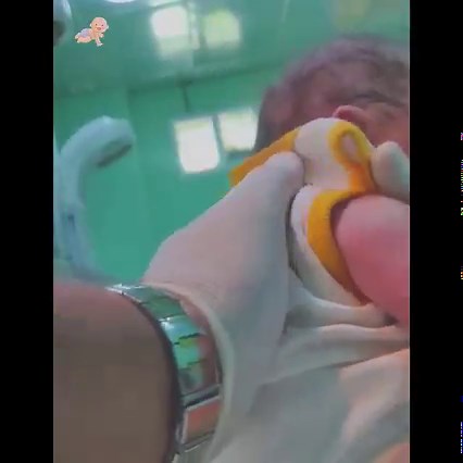 3.5K views · 86 reactions | The doctor treats the baby carefully and thoughtfully. Bow to him and best wishes!❤#baby #newborn #first #trending #viral #reels #crying #cutebaby #cutemoments #shorts #babycraying #funnybaby #pregnancy | Baby stories | Facebook