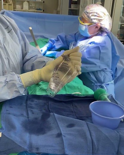 Watch This Large Implant Be Placed In A Keller Funnel!