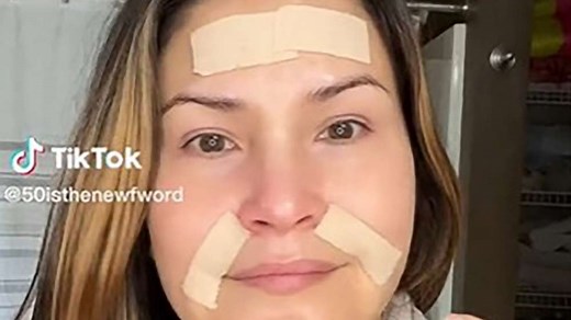Does the TikTok trend of face taping to stop wrinkles work? A doctor weighs in