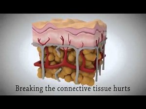 How Using Red Light Therapy For Fast Weight Loss Works