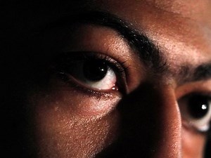 Anthony Davis's Unibrow Among the Greatest in History