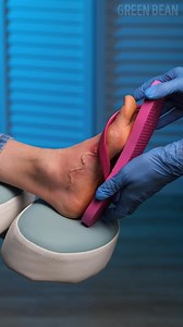 1.5M views · 4.7K reactions | Precision and skill — medical removal simulation | Green Bean | Facebook