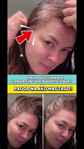 Lara Quigaman chooses self-love over perfection—embracing her natural white hair.