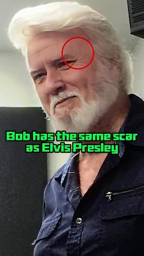 Bob Joyce: The Man with Elvis Presley's Scar